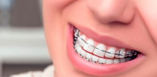 ESTAMOS CONTRATANDO ESPECIALISTAS EN ORTODONCIA PARA AYUDAR A CUBRIR LAS NECESIDADES DE SALUD DENTAL DE SUS PACIENTES